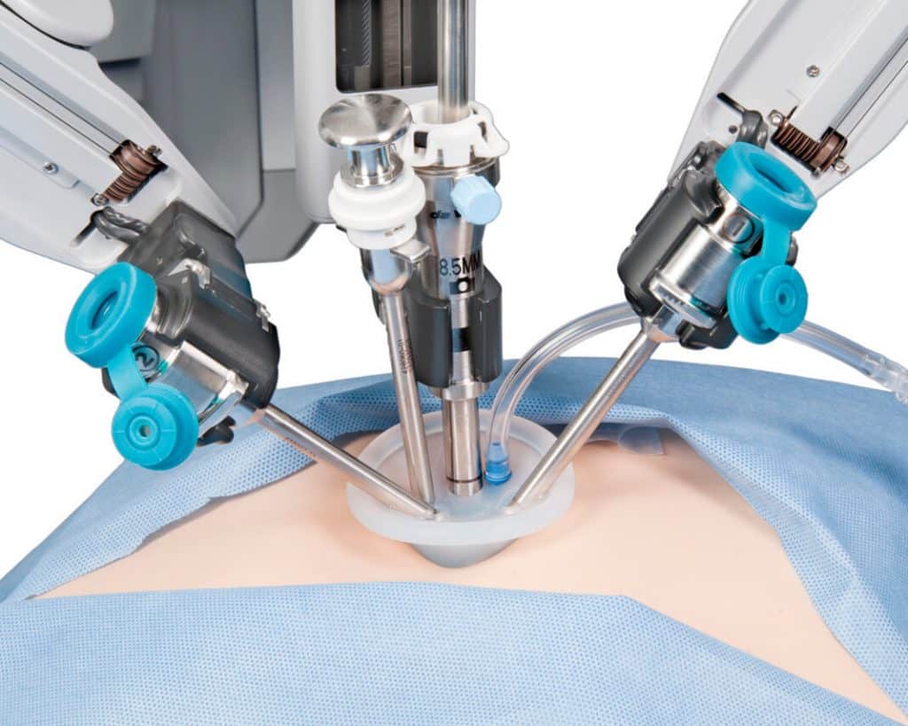 cirurgia robótica abdomen