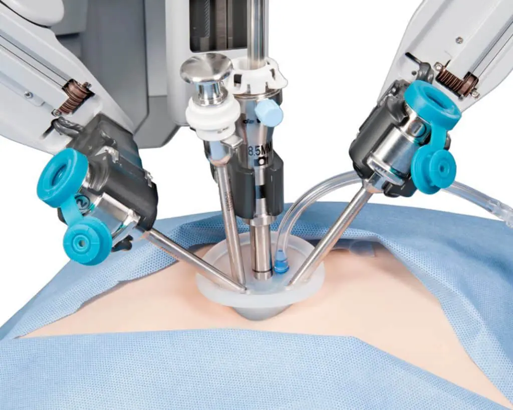 cirurgia robótica abdomen