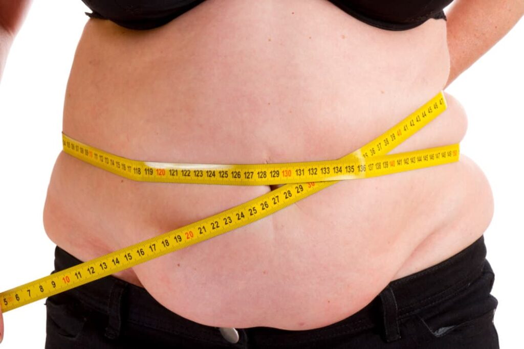 obesidade cirurgia bariatrica