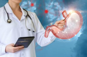 estômago após cirurgia bariátrica