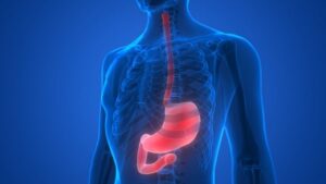 H. Pylori é Câncer?