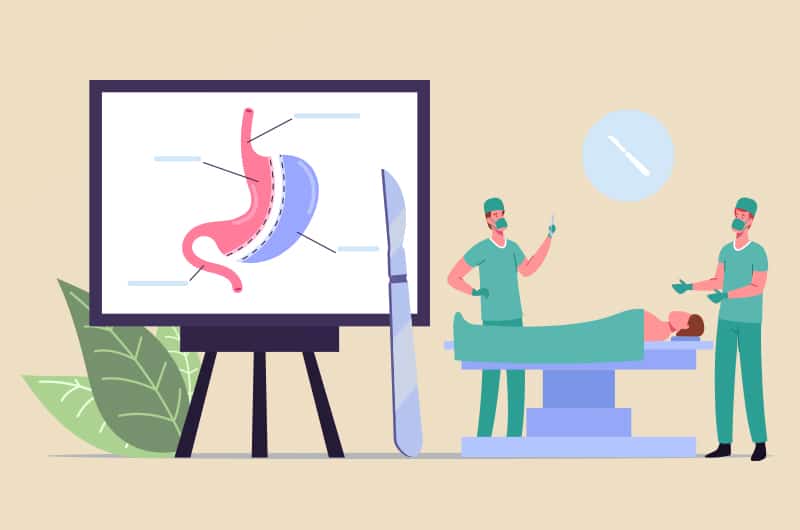 Mitos sobre Cirurgia Bariátrica